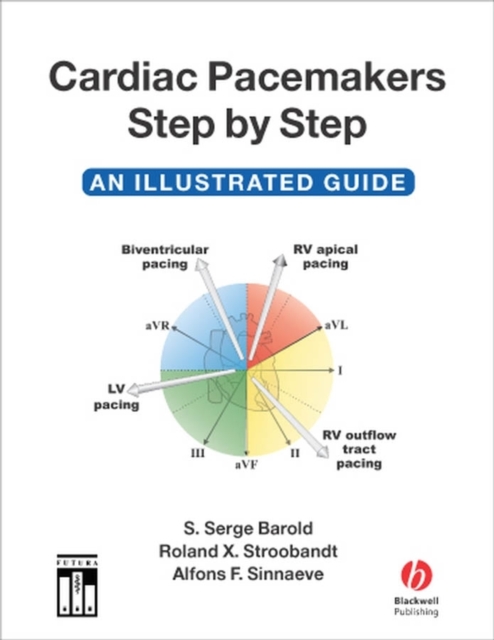 Cardiac Pacemakers Step by Step : An Illustrated Guide, PDF eBook