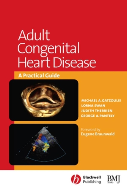 Adult Congenital Heart Disease : A Practical Guide, PDF eBook
