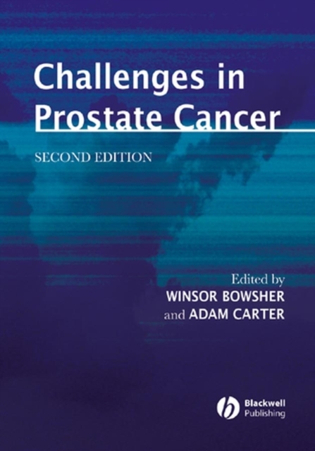 Challenges in Prostate Cancer, PDF eBook