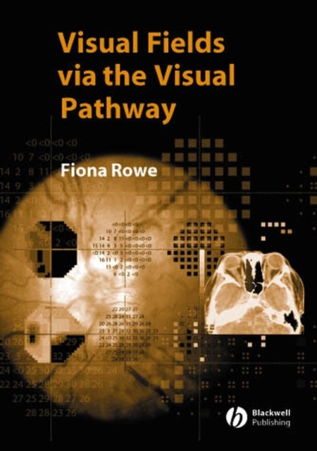 Visual Fields via the Visual Pathway, PDF eBook