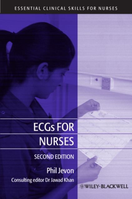 ECGs for Nurses, Paperback / softback Book