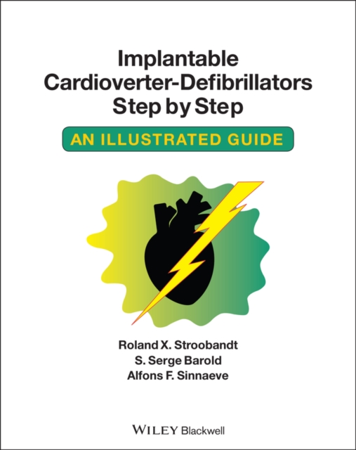 Implantable Cardioverter - Defibrillators Step by Step : An Illustrated Guide, Paperback / softback Book