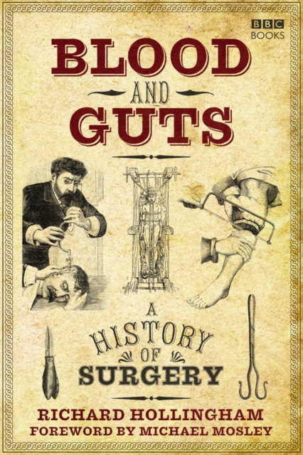 Blood and Guts : A History of Surgery, EPUB eBook