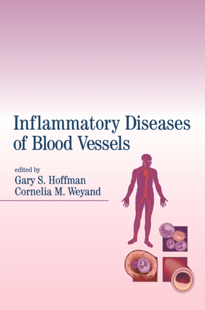 Inflammatory Diseases of Blood Vessels, PDF eBook