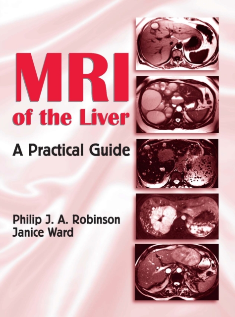 MRI of the Liver : A Practical Guide, PDF eBook