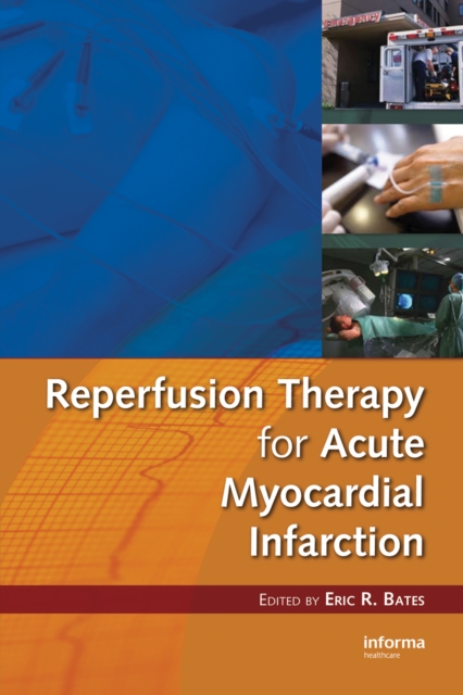 Reperfusion Therapy for Acute Myocardial Infarction, PDF eBook