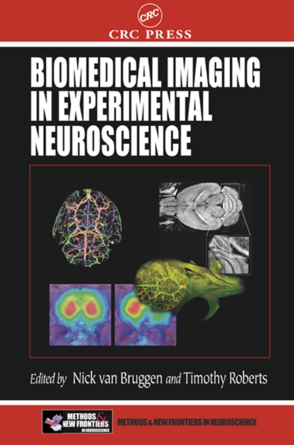 Biomedical Imaging in Experimental Neuroscience, PDF eBook