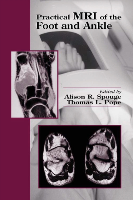 Practical MRI of the Foot and Ankle, PDF eBook