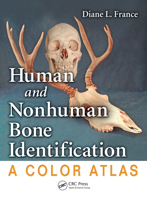Human and Nonhuman Bone Identification : A Color Atlas, PDF eBook