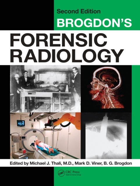Brogdon's Forensic Radiology, PDF eBook