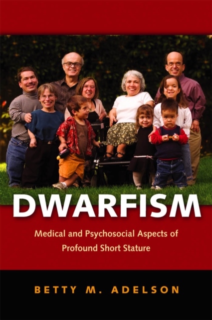 Dwarfism, EPUB eBook