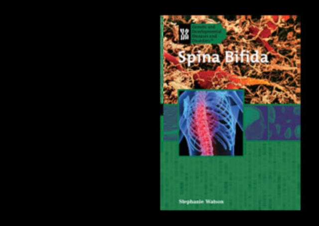 Spina Bifida, PDF eBook