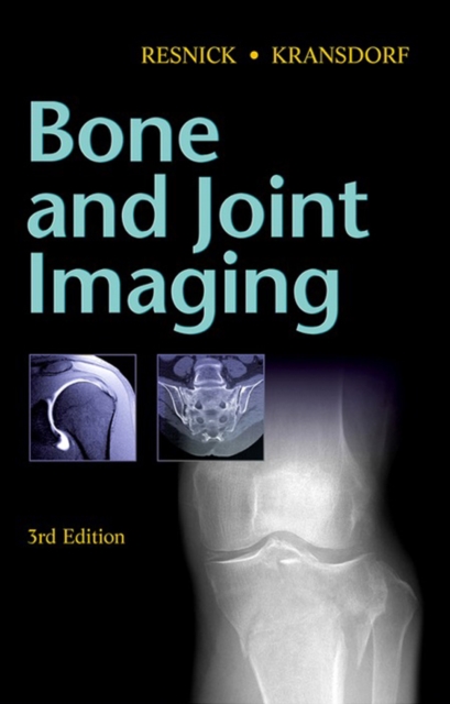 Bone and Joint Imaging, EPUB eBook
