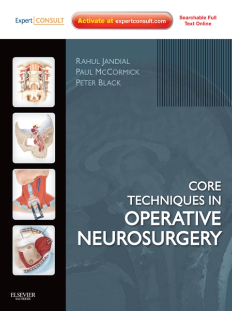 Core Techniques in Operative Neurosurgery E-Book : Expert Consult - Online, EPUB eBook