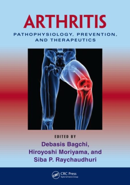 Arthritis : Pathophysiology, Prevention, and Therapeutics, PDF eBook