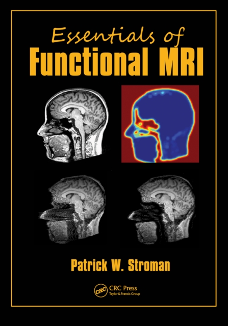 Essentials of Functional MRI, PDF eBook