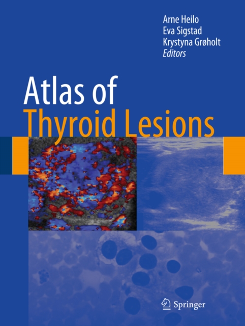 Atlas of Thyroid Lesions, PDF eBook