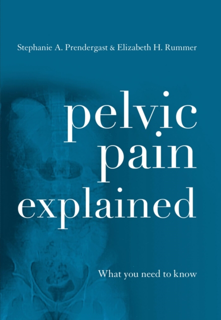 Pelvic Pain Explained : What You Need to Know, EPUB eBook