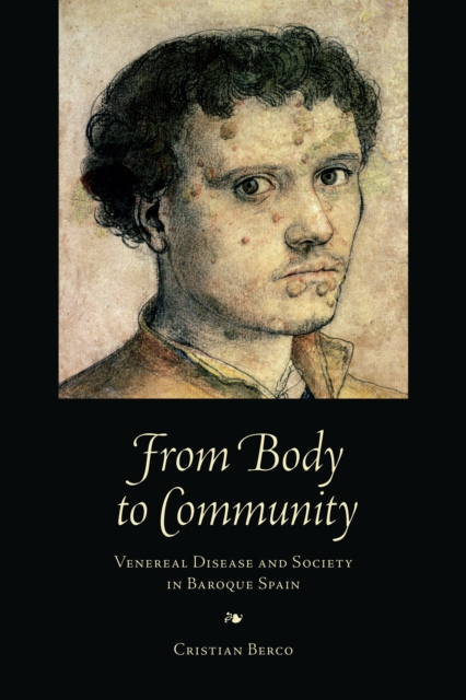 From Body to Community : Venereal Disease and Society in Baroque Spain, EPUB eBook
