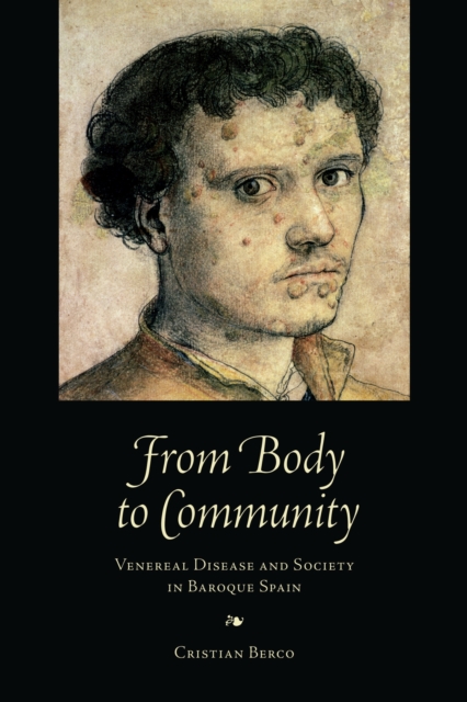 From Body to Community : Venereal Disease and Society in Baroque Spain, EPUB eBook