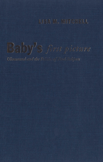Baby's First Picture : Ultrasound and the Politics of Fetal Subjects, PDF eBook