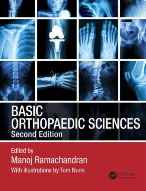 Basic Orthopaedic Sciences, Paperback / softback Book