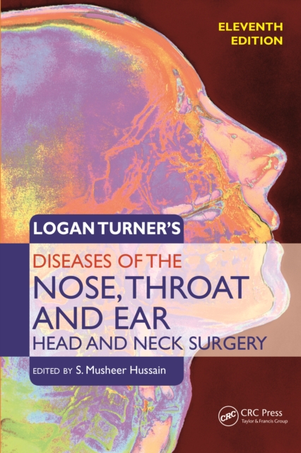 Logan Turner's Diseases of the Nose, Throat and Ear, Head and Neck Surgery, PDF eBook
