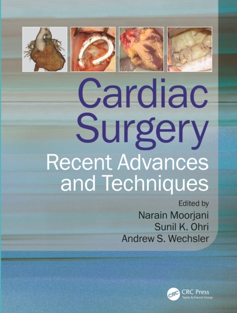 Cardiac Surgery : Recent Advances and Techniques, PDF eBook