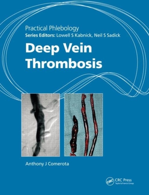 Practical Phlebology : Deep Vein Thrombosis, PDF eBook