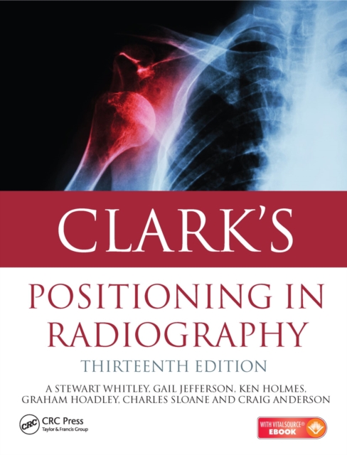 Clark's Positioning in Radiography 13E, PDF eBook