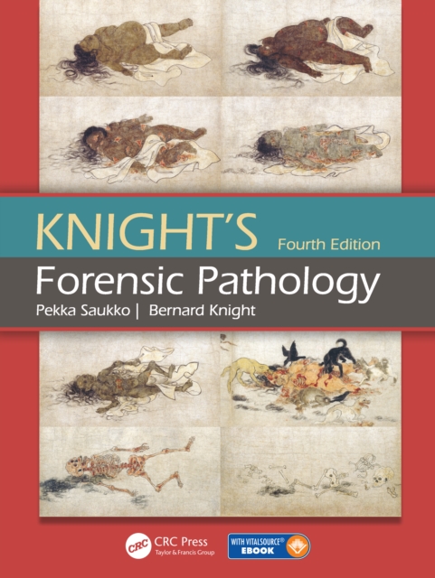 Knight's Forensic Pathology, PDF eBook