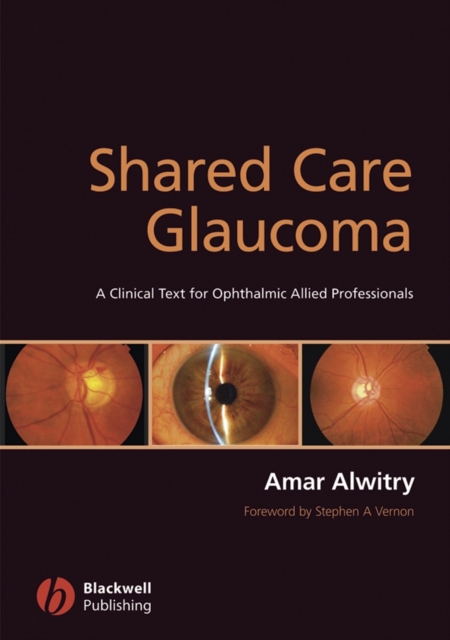 Shared Care Glaucoma, PDF eBook