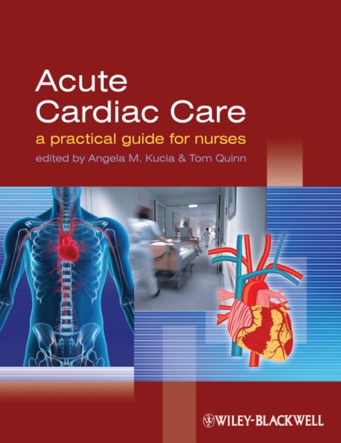 Acute Cardiac Care : A Practical Guide for Nurses, PDF eBook