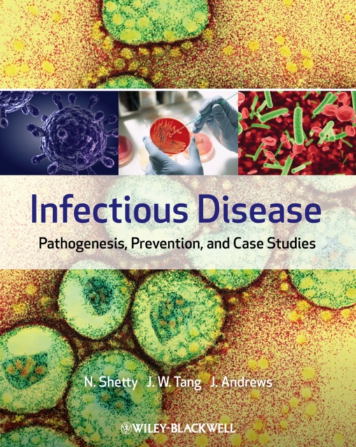 Infectious Disease : Pathogenesis, Prevention and Case Studies, PDF eBook