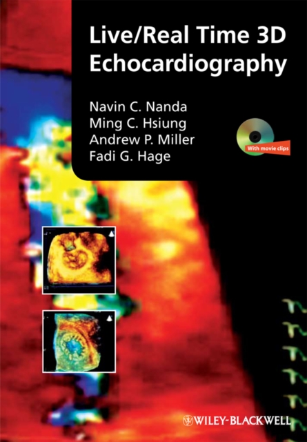 Live/Real Time 3D Echocardiography, PDF eBook