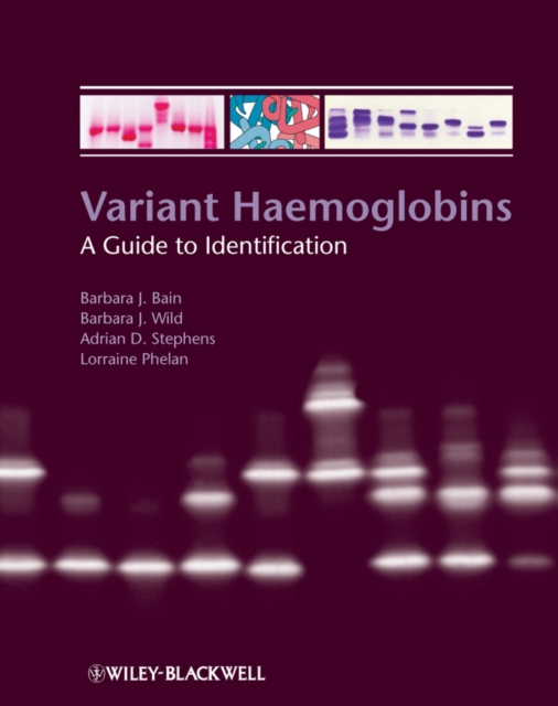 Variant Haemoglobins : A Guide to Identification, PDF eBook