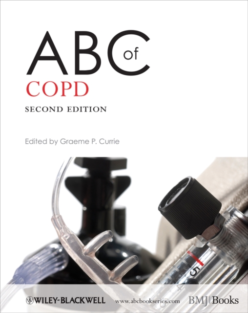 ABC of COPD, EPUB eBook