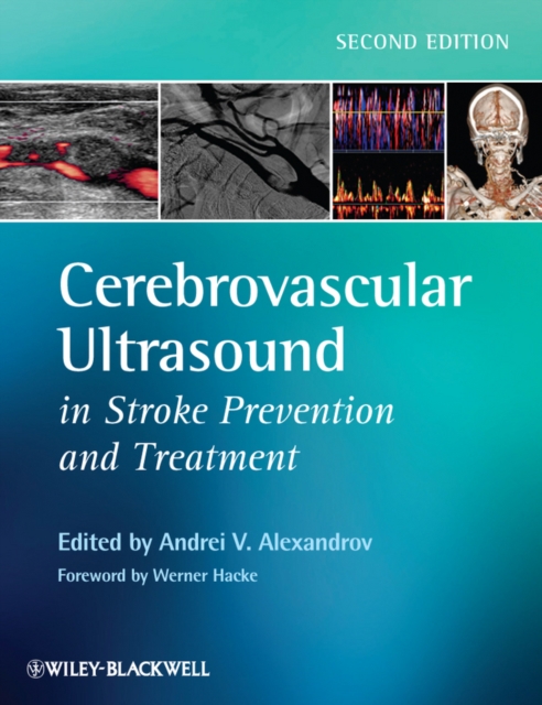 Cerebrovascular Ultrasound in Stroke Prevention and Treatment, EPUB eBook