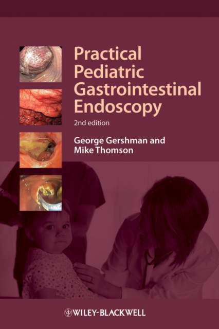 Practical Pediatric Gastrointestinal Endoscopy, PDF eBook