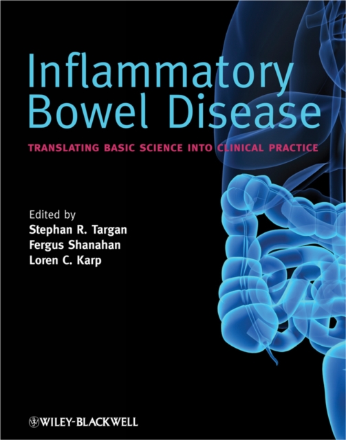 Inflammatory Bowel Disease : Translating Basic Science into Clinical Practice, EPUB eBook