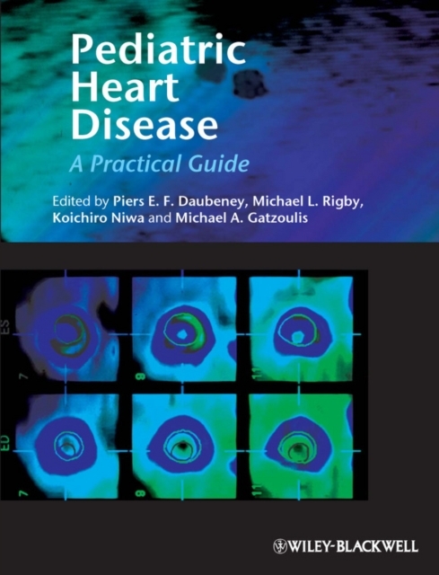 Pediatric Heart Disease, PDF eBook