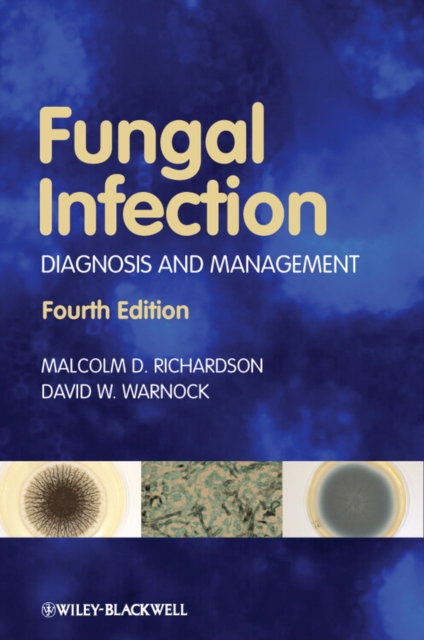 Fungal Infection : Diagnosis and Management, EPUB eBook