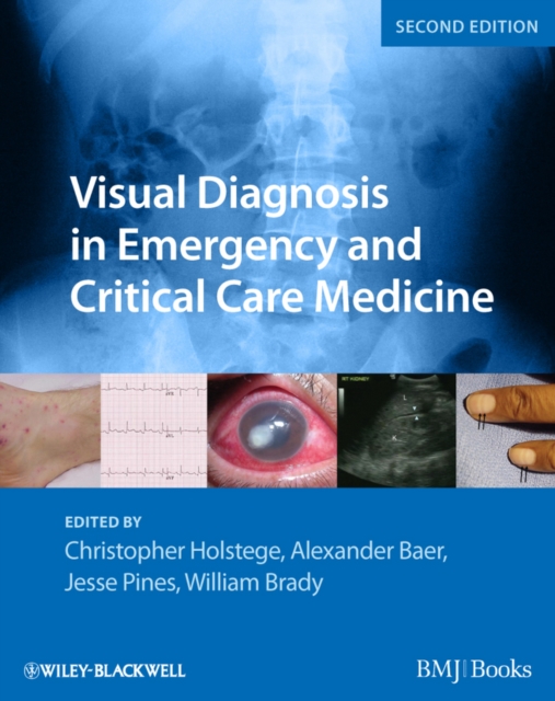 Visual Diagnosis in Emergency and Critical Care Medicine, PDF eBook