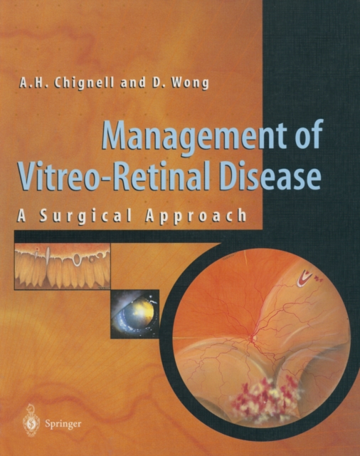 Management of Vitreo-Retinal Disease : A Surgical Approach, PDF eBook