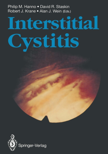 Interstitial Cystitis, PDF eBook