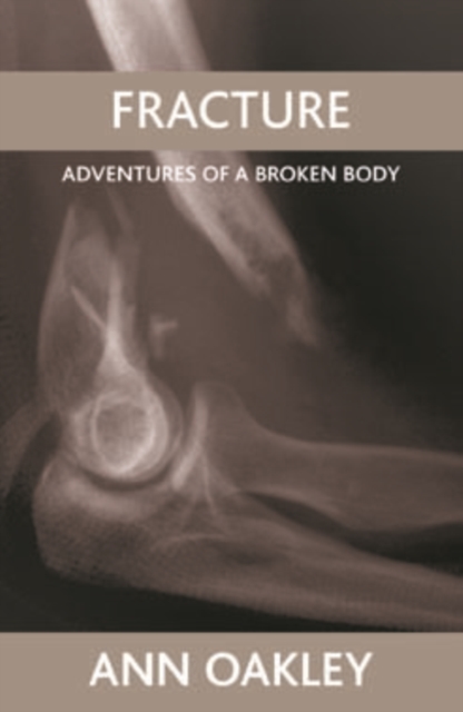 Fracture : Adventures of a broken body, EPUB eBook