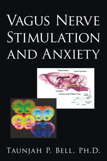 Vagus Nerve Stimulation and Anxiety, EPUB eBook