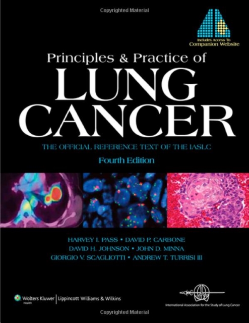 Principles and Practice of Lung Cancer : The Official Reference Text of the International Association for the Study of Lung Cancer (IASLC), EPUB eBook
