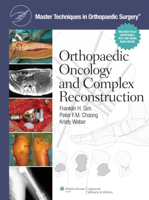 Master Techniques in Orthopaedic Surgery: Orthopaedic Oncology and Complex Reconstruction, EPUB eBook