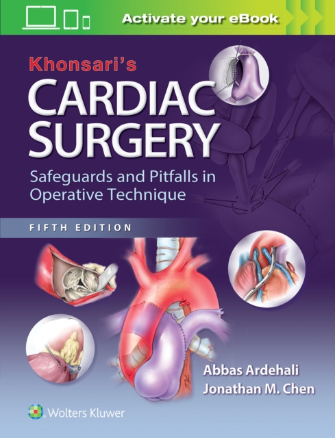 Khonsari's Cardiac Surgery: Safeguards and Pitfalls in Operative Technique, Hardback Book